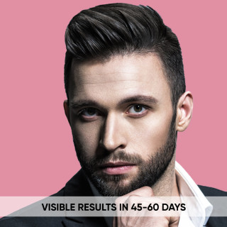 0.75 mm Micro-Needling Derma Roller With 540 Stainless Steel Needles