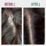 Berkowits Clear Shampoo for oily scalp and Anti Dandruff Get free Clear Conditioner (440ml)