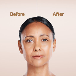 Renew Anti Aging Night Cream with Retino - 30ml