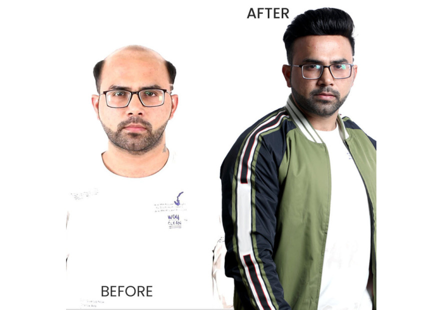 How Men's Hair Wigs Are Revolutionizing the Fashion Industry How Men's Hair Wigs Are Revolutionizing the Fashion Industry